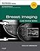Breast Imaging: Case Review Series, 2e