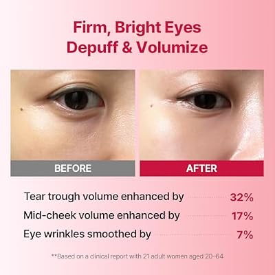 MEDITHERAPY Wrinkle-fit Tangle Eye Patch - Under Eye Patches for Dark Circles and Puffy Eyes - Eye Bags Treatment for Women - Mega Collagen Gel Pads for Puffiness - Firming & Deep Hydrating - 4EA