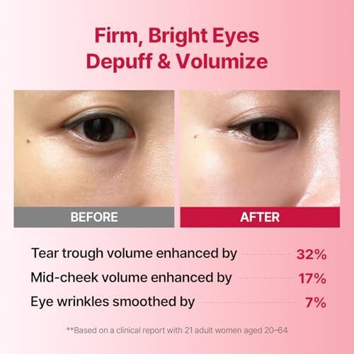 wrinkle-fit tangle eye patch - under eye patches for dark circles and puffy eyes - eye bags treatment for women - mega collagen gel pads for puffiness - firming amp deep hydrating - 4ea