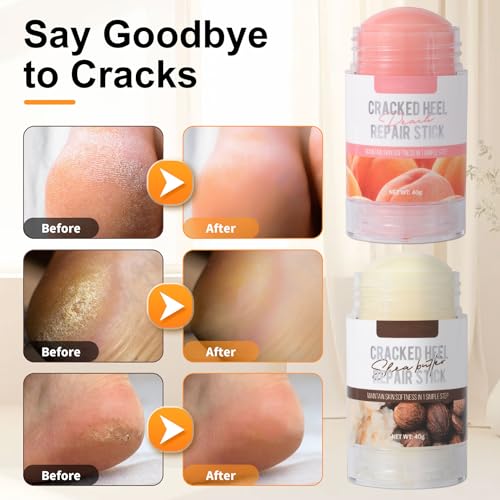 Grospe Shea Butter Dry Cracked Hands and Feet Repair Stick, Moisturizing Foot Cream with Shea Butter and Coconut Oil，Moisturizes and Softens Heels, Gently Exfoliates and Improves Dry Skin，1.41 OZ