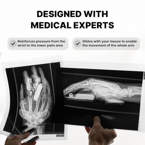 DELTAHUB Carpio 2.0 - Right-Handed Truly Ergonomic Wrist Rest for Mouse, Carpal Tunnel Support, Pain Relief, Anti-Fatigue, Easy Glide, Sleek, Office Computer, Laptop, Gaming - Small, Grey - Image 3