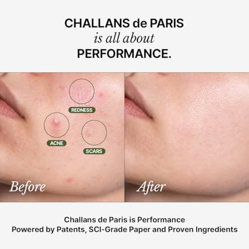 CHALLANS DE [CHALLANS de PARIS] Ampoule d’Aurora Excellence – Soothing & Balancing Skin-Barrier Support Serum with Niacinamide, Oligo-HA & Ceramide | Lightweight Watery, Hydrating Korean Skincare, 1.23 fl oz