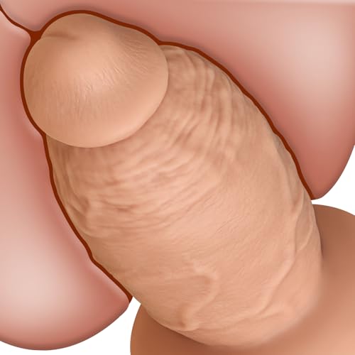 3.8 Inch Diameter Thick Anal Dildo, 7.5 Inch Realistic Huge Silicone Girth Dildo Anal Plug with Suction Cup & No Balls for Deeper Anal Stretcher, Massive Fat Dildos Gay Sex Toy for Advanced Player