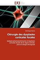 Chirurgie Des Dysplasies Corticales Focales 6131568251 Book Cover