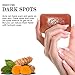 HERBOGANIC Turmeric Herbal Soap | Pack of 1 of 5oz soap Bar | Natural Soap Bar| Rejuvenating and Nourishing | Gentle for Men and Women