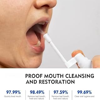 Mouth U-lcer Treatment,S-ore Mouth and Tongue Treatment,C-Anker S-ore Treatment,Severe Mouth U-lcer Treatment,Mouth U-lcer Treatment for Adults,Dry Mouth Oral U-lcers Spray,Mouth Freshener Spray