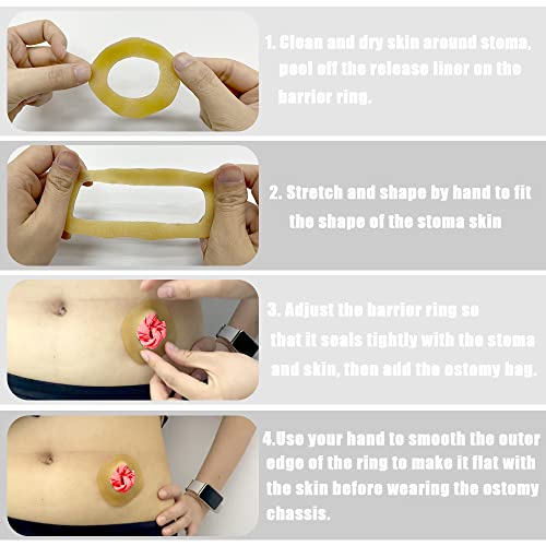 MUROCEA Ostomy Barrier Ring with Directional Spout - 4mm Thickness Disposable Colostomy Cohesive Seal Strip for Ileostomy Stoma System, Outer Dia.2~4", 10 Pcs