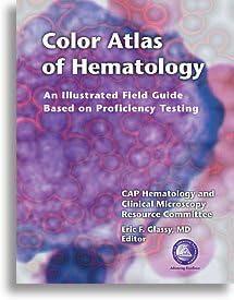 Color Atlas of Hematology (Illustrated Field Guide Based on Proficiency Testing) Hardcover – January 1, 2005