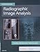 Radiographic Image Analysis