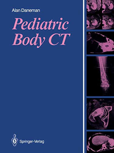 Pediatric Body CT view 2