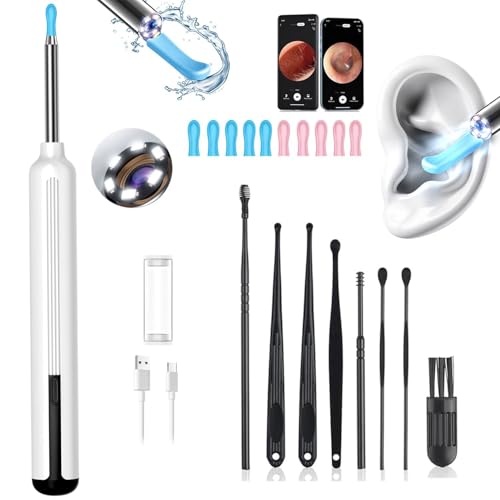 Ear Wax Removal, Ear Wax Removal Tool Camera with 1080P and 6 LED Lights, Ear Cleaner with 10 Replacement Tips, Earwax Removal Kit with Camera and 7 Pcs Ear Picks for Android/iOS