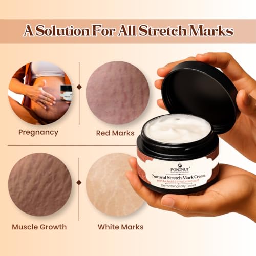 Image of POKONUT Stretch Mark Repair Combo, Cream & Roll-On Serum, with Hyaluronic Acid, Rosehip Oil, Vitamin E, Day & Night Routine, 100g