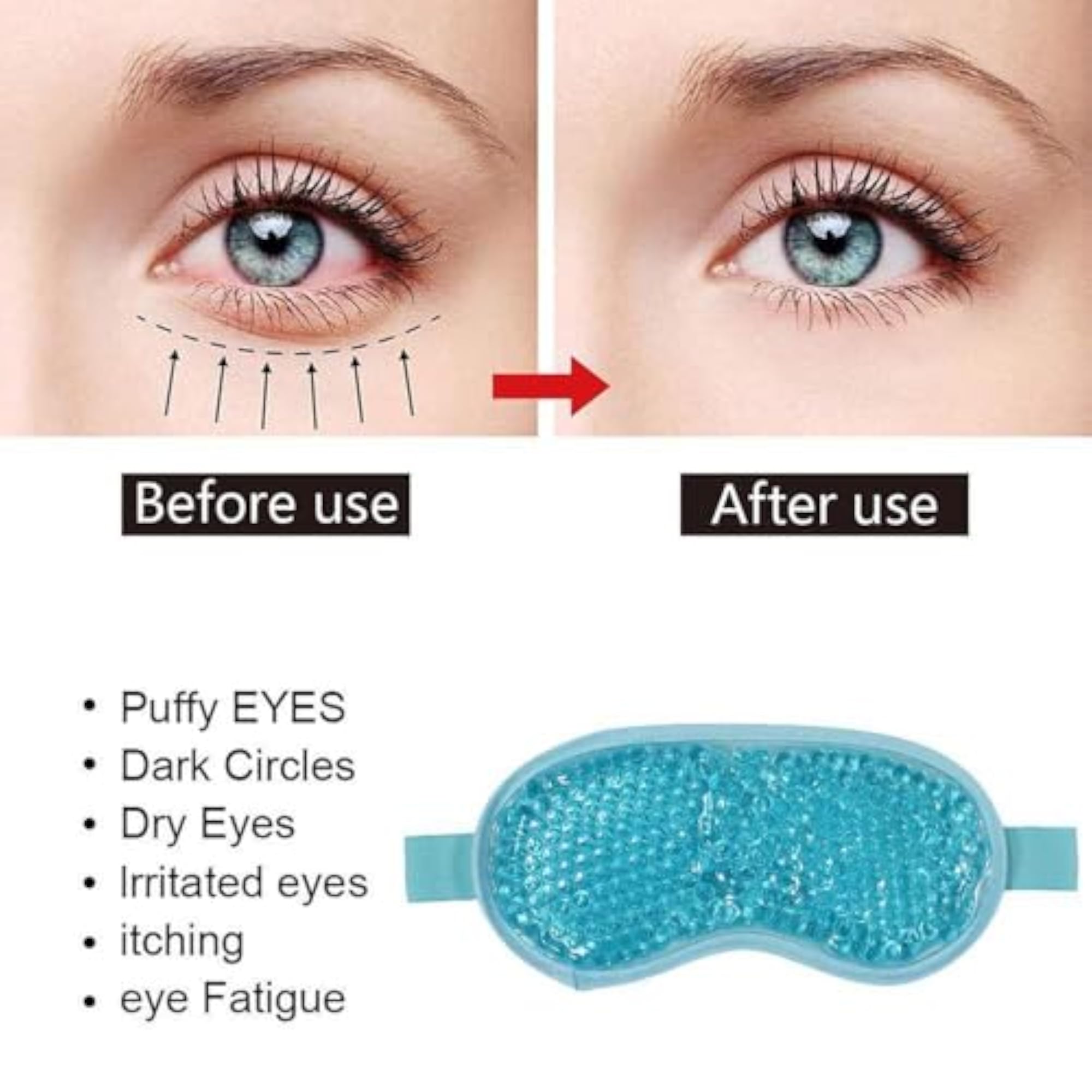 Gel Eye Mask for Puffy Eyes & Dark Circles
