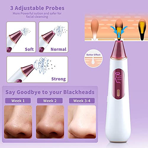 RaMokey Mitesserentferner Porenreiniger mit Kamera, Beauty Device Mitesser Entferner Porensauger, Visuell Mitesser… – Bild 5