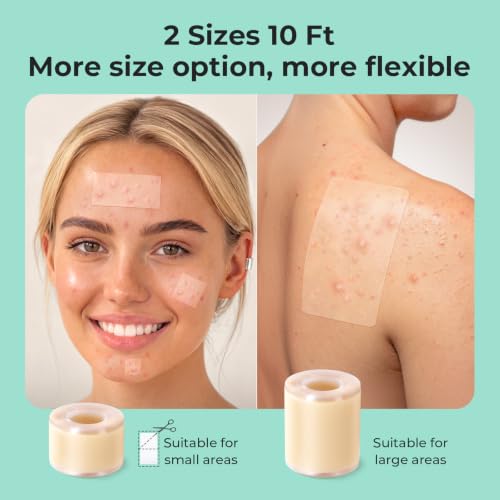 Image of TKTK Hydrocolloid Roll 2 Sizes, Cut-to-Fit Bandages for Pimple & Wounds