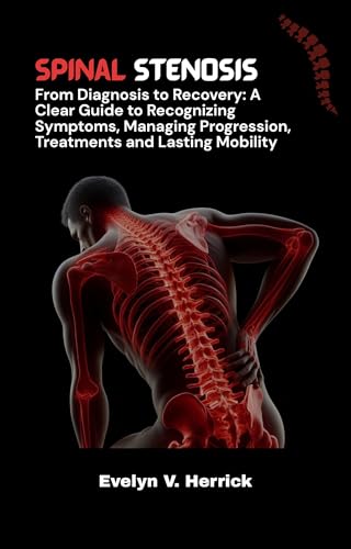 Spinal Stenosis: From Diagnosis to Recovery: A Clear Guide to