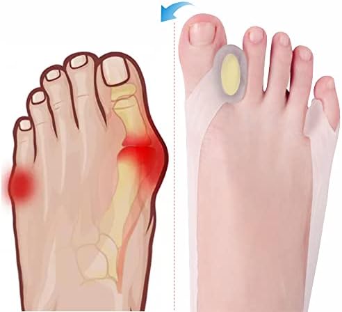 Ashomie New Generation Toe Separator Toe Corrector Toe spacers for Women can be Adjusted can be Worn Shoes (2PC) Size:5-8