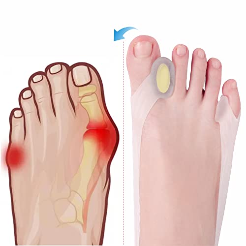 Ashomie New Generation Toe Separator Toe Corrector Toe Spacers For Women Can Be Adjusted Can Be Worn Shoes (2Pc) Size:5-8 #TOP28