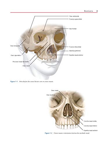Rinoplastia: Atlas de Cirurgia Plástica