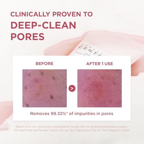 SKIN1004 Sofdesk Madagaskar Centella poremizing Deep Cleansing Foam (środek do czyszczenia piany, reduktor porów)