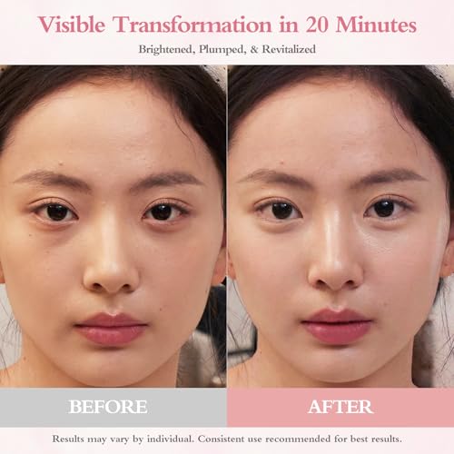 64% Off PDRN Eye Patches with Code RF8YDR2J - Anti-Aging & De-Puffing