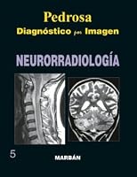 NEURORRADIOLOGÍA. T.D. Gran Formato. Ó 2008 8471015978 Book Cover