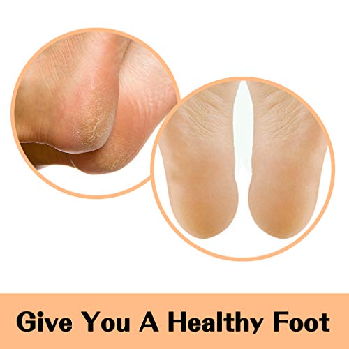 Lagunamoon Foot Cream For Dry Cracked Feet - Urea, Vitamin E & Hyaluronic Acid Foot Moisturizer For Dry Skin, Rough, Calloused, Cracked Feet Repair And Soften, Non-Greasy & Fast Absorbing (5.3 Oz) #TOP4