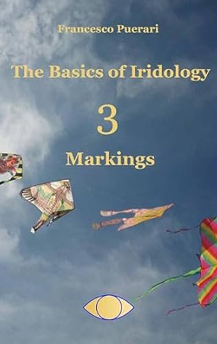 The Basics of Iridology 3 - Markings