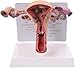 Imagen de Generico Modelo de útero en 3D Modelo de útero Modelo de ovario Anatomía humana Anatomía del aparato reproductor femenino Réplica de anatomía para médicos Herramienta educativa