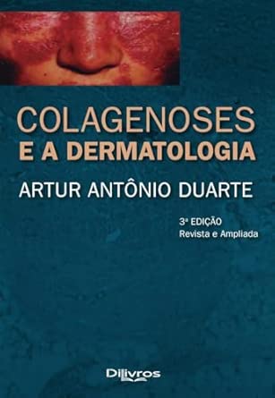 COLAGENOSES E A DERMATOLOGIA