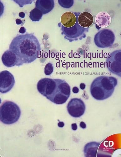 Les 10 meilleurs Liquides d&rsquo;opération – Edition octobre 2026