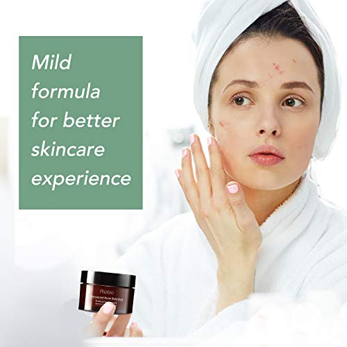 Akne Behandlung Anti Akne Spot Pickel Creme Makel Breakout Behandlung Gesicht Akne Narbenentfernung Gel-Creme reduziert Rötungen natürliche Hautpflege (60 g) - Image 7