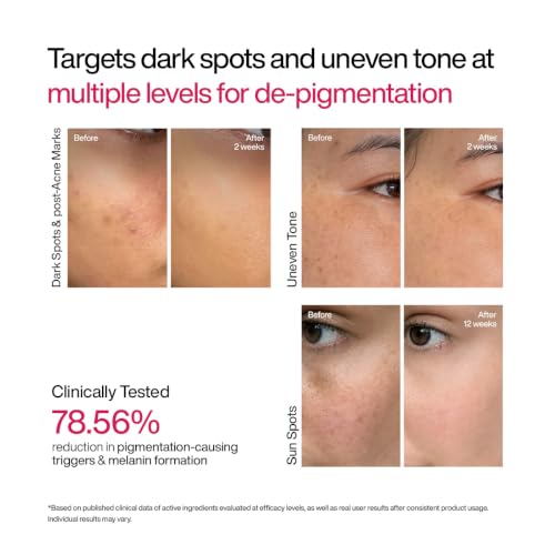 Image of WishCare Advanced Dark Spot Correcting Serum - TXA Shot | 10% Niacinamide Serum For Pigmentation and Dark Spot | With 2% Alpha Arbutin & TXA for Glowing Skin | 30ml