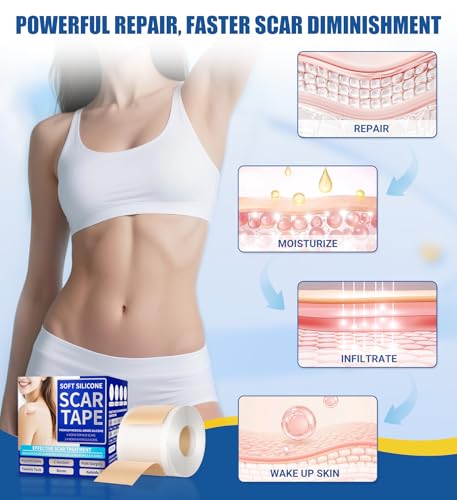 Medical Grade Silicone Scar Sheets & Tape - 1.6”x60" Roll, Ultra Soft, Hypoallergenic Rolls for Surgical, Keloid Scars, Tummy Tuck, C-Section, Stretch Marks, Burn & Bumps Scar Removal, 24H Comfortable — view 4