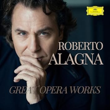 Amazon Music Unlimitedでロベルト・アラーニャを聴こう