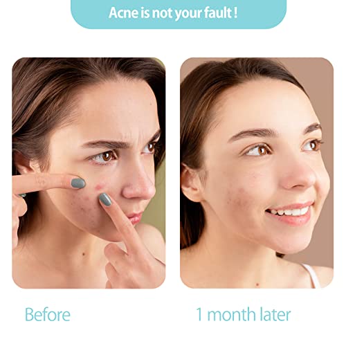 Disposable Face Towel Clean Face Tissue Skin Soft And Thick For Make Up, Baby Organic Cruelty Free Degradable By Ruijiu #TOP1