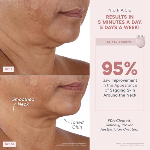 Nuface 42022 Mini+ Microcurrent Facial Device Kit thumb #2