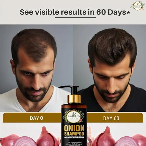 Image of Luxura Sciences Onion Oil Shampoo For Hair Growth 300 ML, Sulphate Free Shampoo (NO Parabens,Silicones or Colorants)