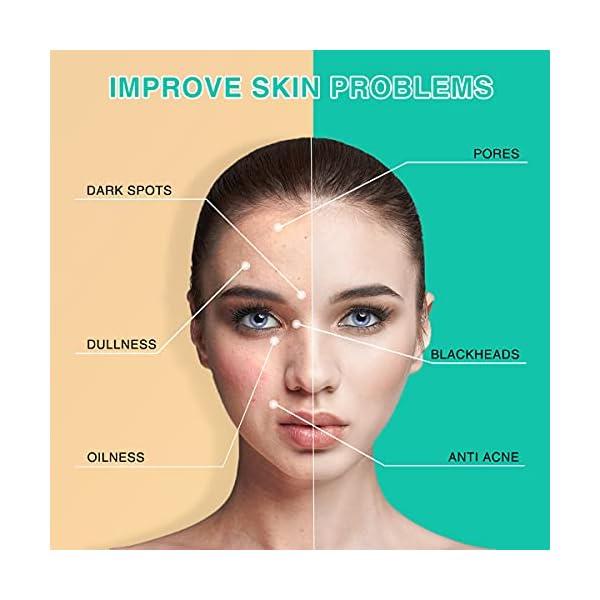 Turmeric-Facial-MaskTurmeric-Mud-Mask-with-Vitamin-C-Kaolin-Clay-and-Turmeric-for-Radiant-SkinOrganic-Turmeric-Face-Mud-Mask-for-Deep-Cleansing-Blackheads-and-Acnes-Control-4-oz FUHUIM Turmeric Clay Mask, 4 oz, Soothing, Brightening, Cleansing, Moisturizing, Pore Treatment, Blackhead Removal, Radiant Skin