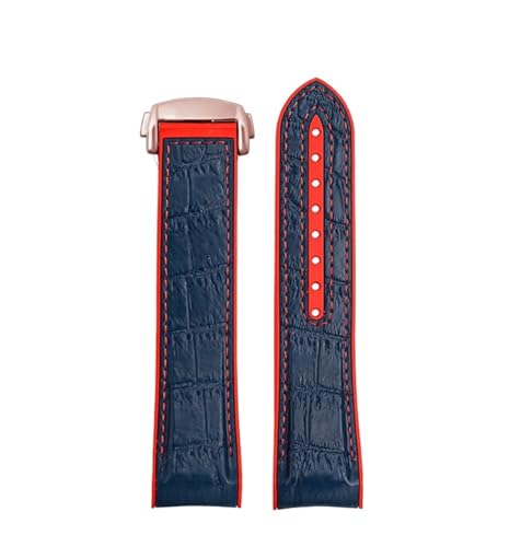 [X] J[uGh̃o[EHb`oh 20mm 22mm IK V[}X^[ 300 AT150ɓK Xs[h}X^[ vlbgɓK I[VɓK ZCR[ɓK Fit For IWCɓK VRXgbv Xgoh(Blue