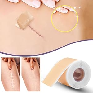 Narbenpflaster, Narbenpflaster Nach Op, Silikonpflaster für Narben, Silikon Narbenpflaster, Selbstklebende Narbenrolle…