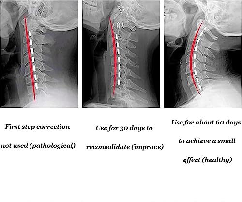Neck brace collier neck support réglable pour traction cervicale postopératoire