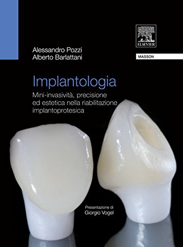 Implantologia: Mini-invasività, precisione ed estetica nella riabilitazione (Italian Edition)