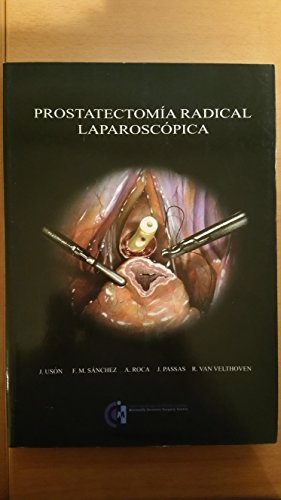 Prostatectomía radical laparoscópica