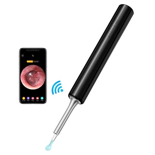 Wireless Digital Otoscope, LOFTer Upgraded 3.9mm 1080P FHD Ear Camera Set, Super Light Ear Wax Remover Tool with Temperature Control Chip, Compatible with Android iOS Smartphone and Tablet (Black)…
