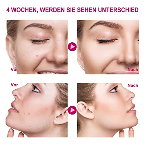 AHA-Peeling ANAiRUi 30% AHA und 2% BHA Serum für Gesichtspflege