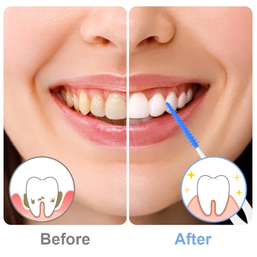 URAQT Interdentalbürsten, 220 Stück Silikon Zahnzwischenraumbürsten, Tragbarer Zahnbürsten Dual-Use Zahnseide Stick Interdentalbürste, Dentalbürsten für Zahnreinigung zwischenräume Werkzeug (Blau)