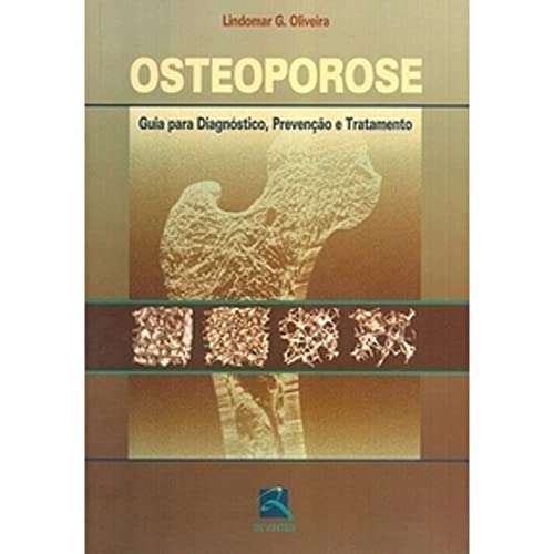 Osteoporose. Guia Para Diagnostico, Prevencao E Tratamento