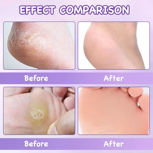 Katyjun 6 Paar Fussmaske Socken, Lavendel Foot Peel Mask Hornhaut und Abgestorbene Haut Entfernen