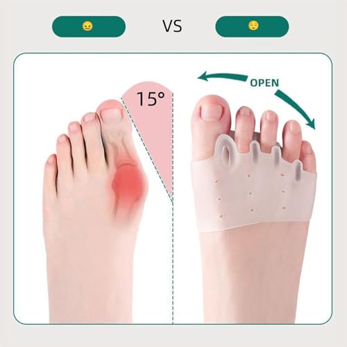 silicone toe separators- 2025 new toe separator for women hallux valgus relief - toe straightener amp spacer for women amp men